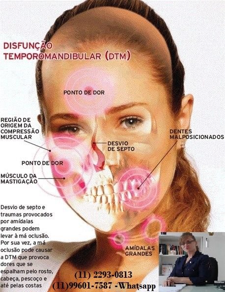 Disfunções temporomandibulares: sintomas e causas